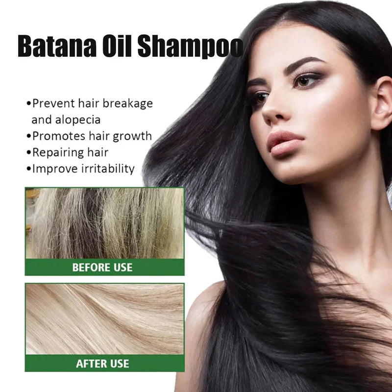 Batana Oil Shampoo for Hair Growth with Rosemary Extractš±āØ