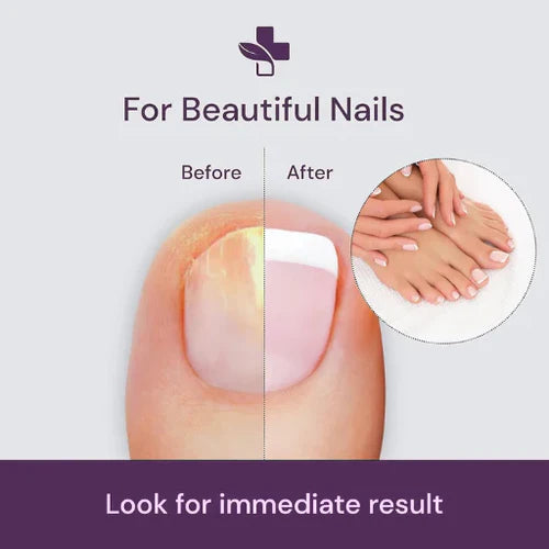 Bee Extract Nail Serum – Fight Fungus, Get Shine Back