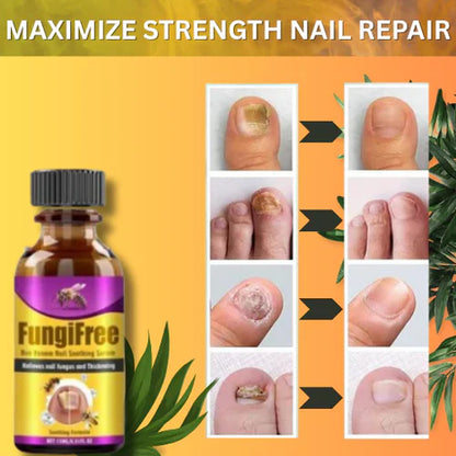 Bee Extract Nail Serum – Fight Fungus, Get Shine Back