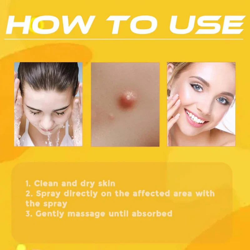 Bee Venom Skin Tag & Wart Remover Spray